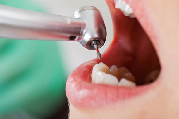 Best Emergency Gum Treatment in Emah, OK